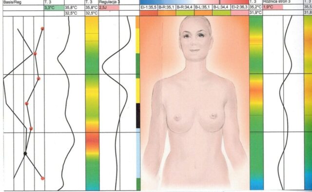 MetodaSTRD (Skaningowa Termografia Regulacyjna) w praktyce psychologicznej